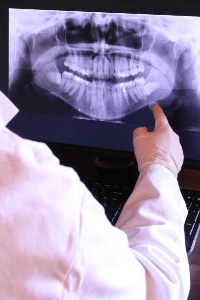 Best Emergency Dentist for Lost Fillings or Crowns in Brownsville, TN