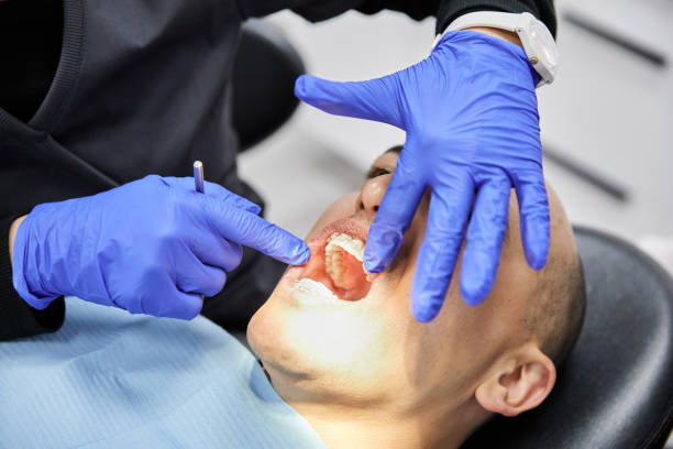 Best Emergency Dentist for Knocked-Out Tooth in Brownsville, TN
