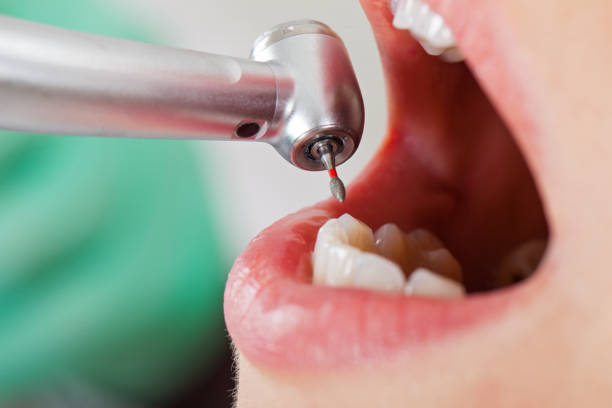 Best Pediatric Emergency Dentist in Brownsville, TN